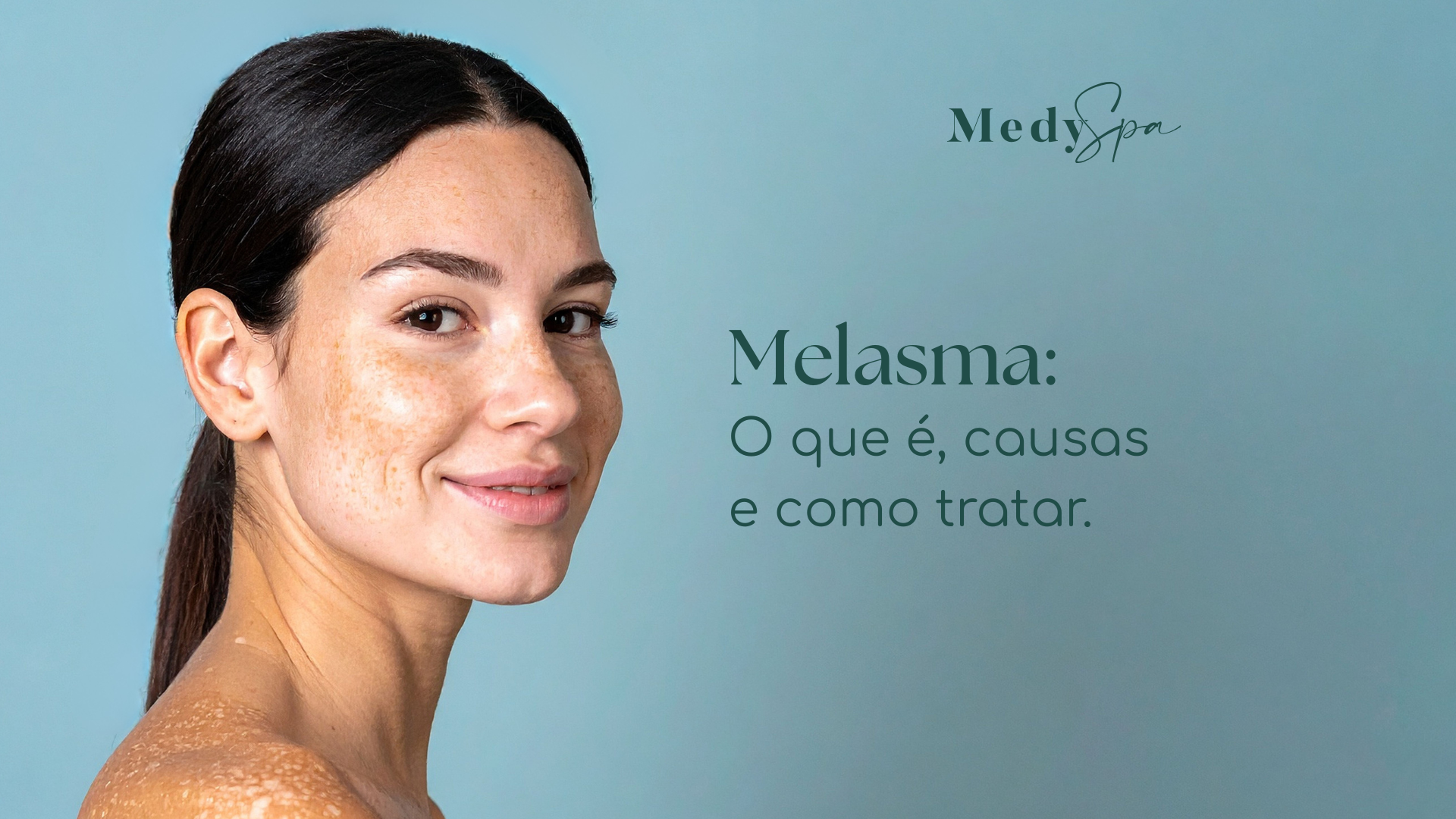 Melasma: o que é, causas e como tratar